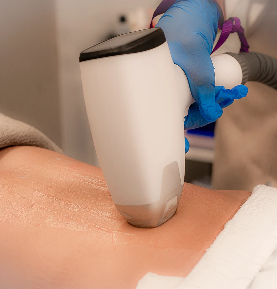 Epilazione laser definitiva a Ventimiglia Italian Beauty