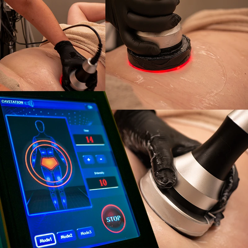 Trattamento Ultrasuoni Estetici a Ventimiglia